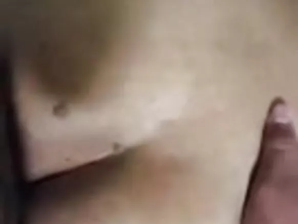 Katika anal prolapse mke, punda mke.