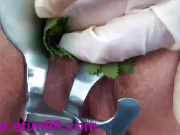 Nettle, ngumi ya anal, uingizaji wa hila na kioo.